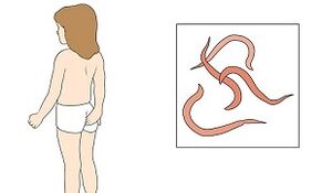 Symptome von Parasiten im menschlichen Körper